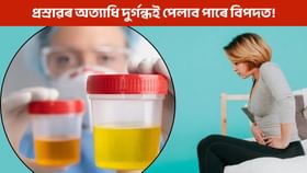 প্ৰস্ৰাৱৰ দুৰ্গন্ধ আৰু জ্বলা-পোৰা… এয়া কি ৰোগৰ লক্ষণ?