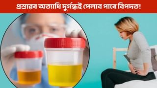 প্ৰস্ৰাৱৰ দুৰ্গন্ধ আৰু জ্বলা-পোৰা… এয়া আপুনি ভয় কৰা কোনো ৰোগৰ লক্ষণ নেকি?