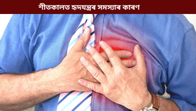 Heart Attack: শীতকালত বৃদ্ধি পাই হাৰ্ট এটেকৰ আশংকা; ৪টা ডাঙৰ কাৰণ কি? জানক চিকিৎসকৰ পৰা…...