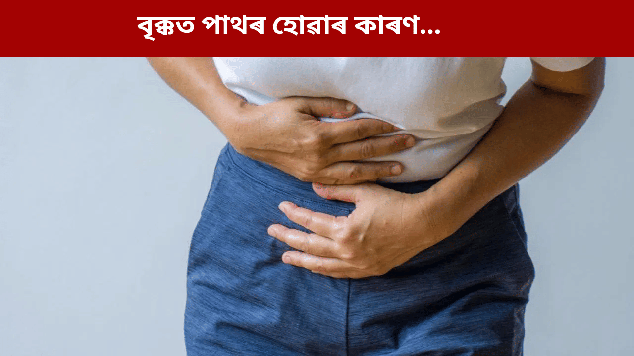 বৃক্কত পাথৰ হোৱাৰ ৩টা মুখ্য কাৰণ, জানক চিকিৎসকৰ পৰা...