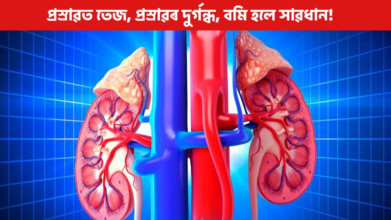 প্ৰস্ৰাৱত তেজ ওলোৱা আৰু দুৰ্গন্ধ… এয়া বৃক্কত পাথৰ হোৱাৰ লক্ষণ নেকি?