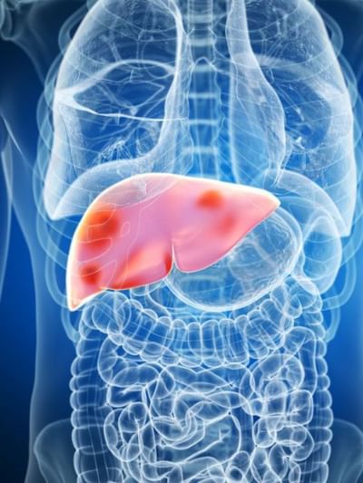 এইবোৰ অভ্যাস আজিয়ে ত্যাগ কৰক, বিশেষজ্ঞৰ পৰা লিভাৰ দুৰ্বল হোৱাৰ কাৰণবোৰ জানক