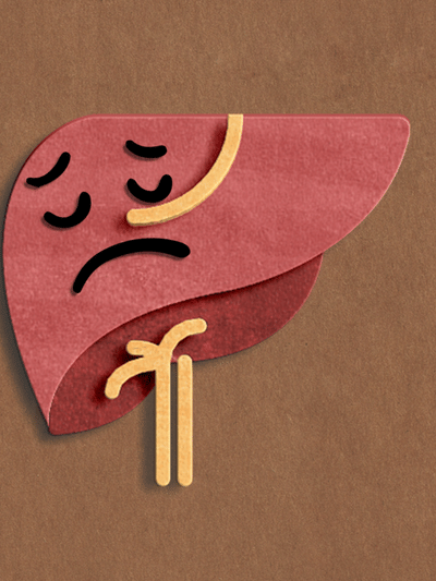 যকৃতত সংক্ৰমণ হ’লে প্ৰাৰম্ভিক অৱস্থাত দেখা দিয়ে এই ৫টা লক্ষণ…