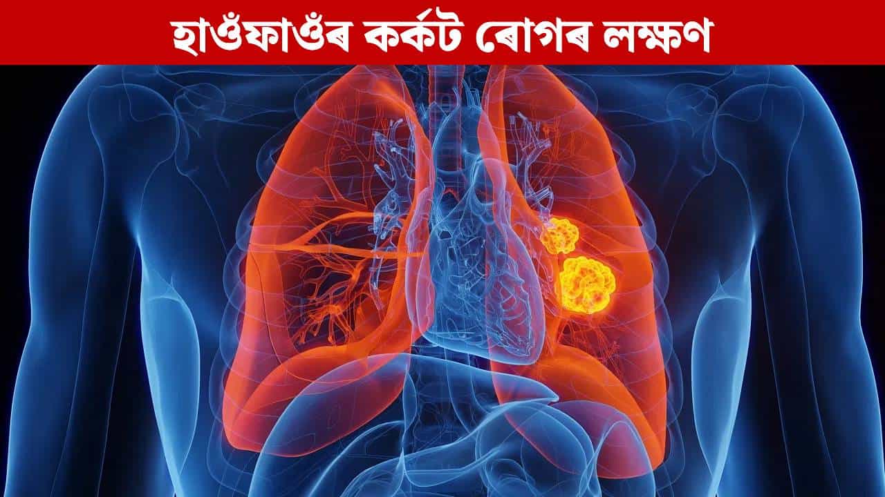 Lung Cancer: হাওঁফাওঁৰ কৰ্কট ৰোগৰ ৪টা প্ৰাৰম্ভিক লক্ষণ কি কি? প্ৰধান কাৰণ জানক...