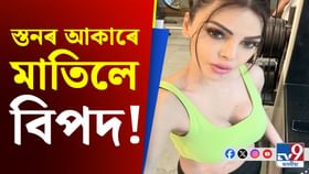 স্তনৰ আকাৰ বৃদ্ধি কৰি বিপদত ছাৰ্লিন চোপ্ৰা! চিকিৎসালয়ত ভৰ্তি...