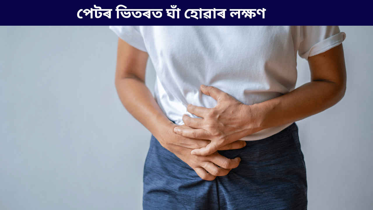 পেটৰ ভিতৰত ঘাঁ  কিয় হয়? ইয়াৰ লক্ষণ কি, জানক সকলো চিকিৎসকৰ পৰা…