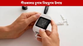 শীতকালত চুগাৰ নিয়ন্ত্ৰণৰ বাবে চিকিৎসকৰ এই পৰামৰ্শসমূহ পালন কৰক