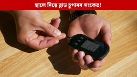 আপোনাৰ ছালে দিয়ে ব্লাড চুগাৰৰ সংকেত! এনে সমস্যাই দেখা দিলেই হওক সাৱধান...