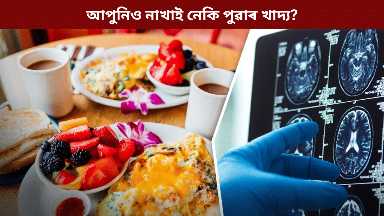 Breakfast: আপুনিও পুৱাৰ আহাৰ নাখাই নেকি? তেন্তে হব পাৰে এইসমূহ সমস্যা... Breakfast: আপুনিও পুৱাৰ আহাৰ নাখাই নেকি? তেন্তে হব পাৰে এইসমূহ সমস্যা...
