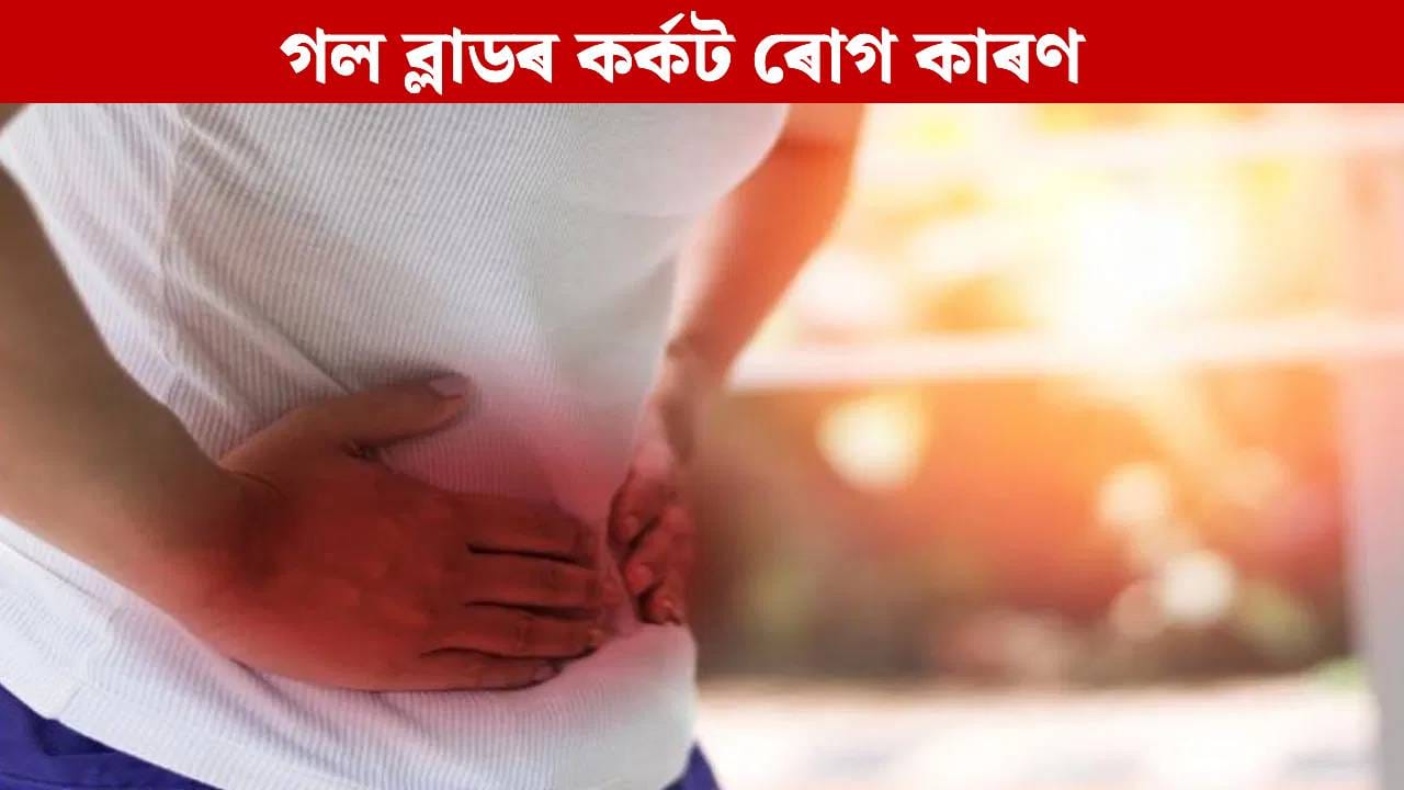 গল ব্লাডৰ ষ্টোন হ’ব পাৰে নেকি মৃত্যুৰ কাৰণ? চিকিৎসকে ক’লে…