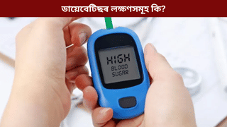 Diabetes: প্ৰস্ৰাৱত দেখা দিয়ে নেকি ডায়েবেটিছৰ লক্ষণ? জানক চিকিৎসকৰ পৰা…