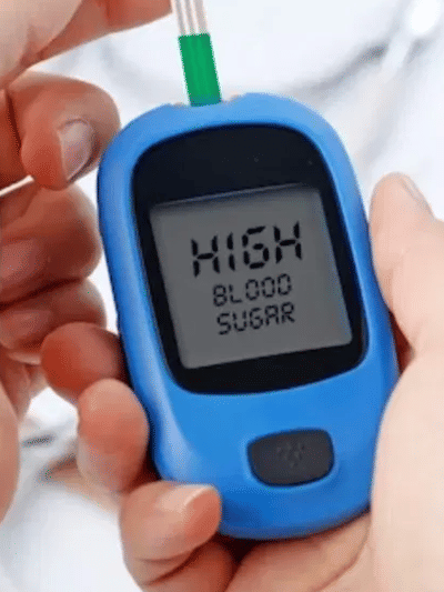 ডায়েবেটিছ ৰোগীয়ে শীতকালত ভুলতো খাব নালাগে এইসমূহ খাদ্য…