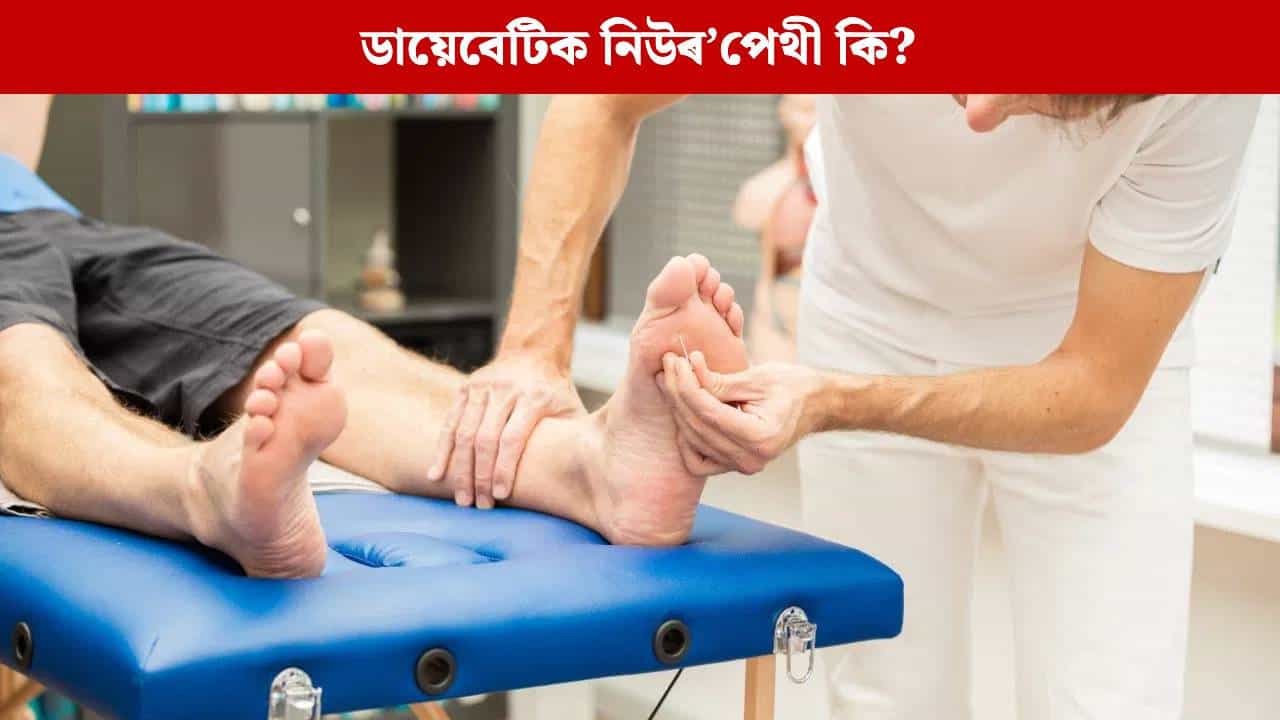 Diabetes: ডায়েবেটিছ ৰোগীসকল সাৱধান! ভৰি জিনজিনাই থাকিলে হ’ব পাৰে গুৰুতৰ ৰোগ...
