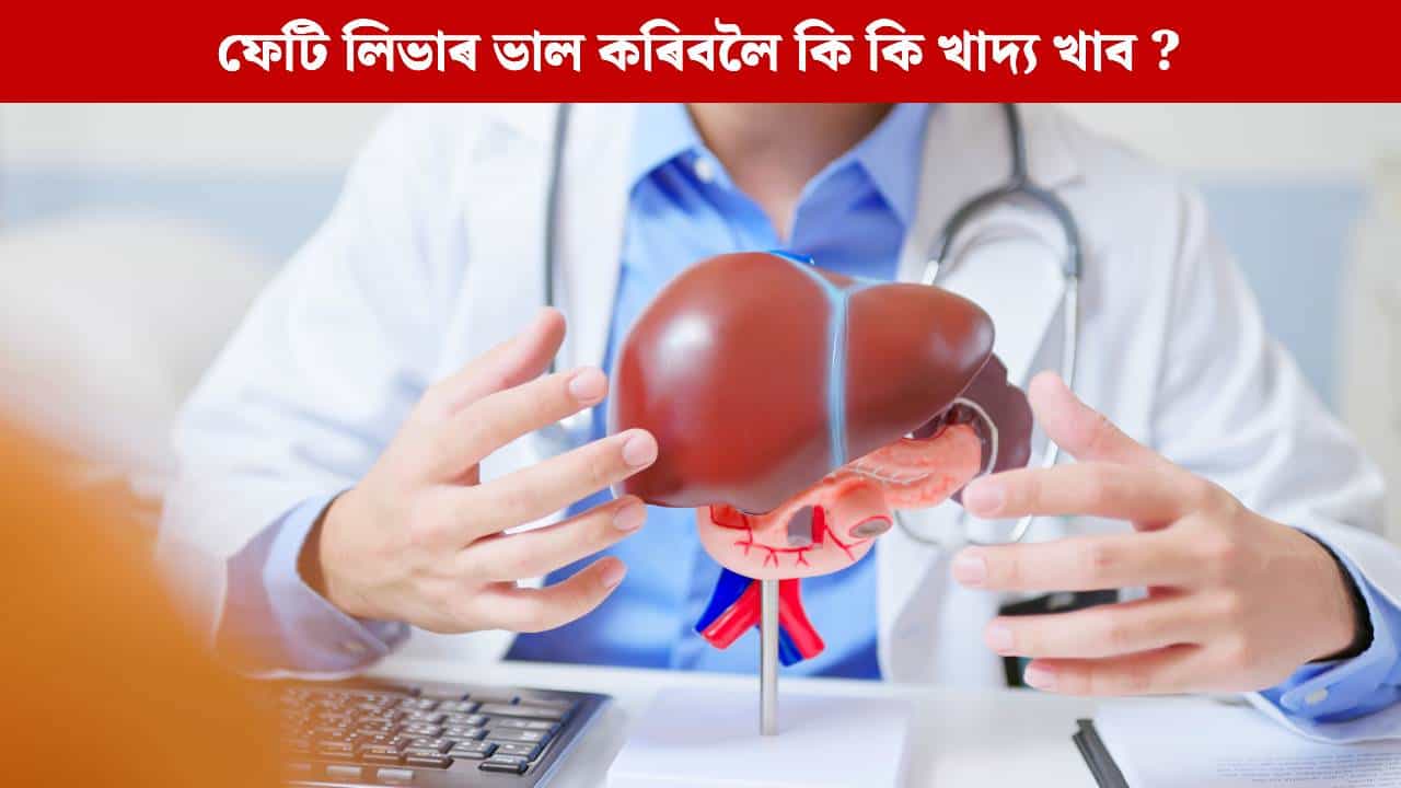Fatty Liver Diet Tips: কম দিনত পাব ফলাফল, ফেটি লিভাৰ প্ৰাকৃতিকভাৱে উন্নত কৰাৰ বাবে খাওক এই ৫ বিধ খাদ্য...