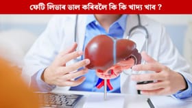 Fatty Liver Diet Tips: কম দিনত পাব ফলাফল, ফেটি লিভাৰ প্ৰাকৃতিকভাৱে উন্নত কৰাৰ বাবে খাওক এই ৫ বিধ খাদ্য…...