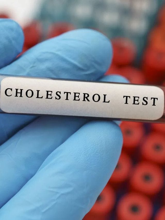 উদ্বেগ, হতাশা বৃদ্ধি পায় নেকি ! ভাল কলেষ্টেৰলৰ মাত্ৰা কম হ’লে কি কি সমস্যা হয়? জানক