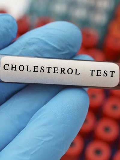 উদ্বেগ, হতাশা বৃদ্ধি পায় নেকি ! ভাল কলেষ্টেৰলৰ মাত্ৰা কম হ’লে কি কি সমস্যা হয়? জানক