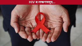 HIV ৰ প্ৰাৰম্ভিক লক্ষণসমূহ কি কি? জানক চিকিৎসকৰ পৰা