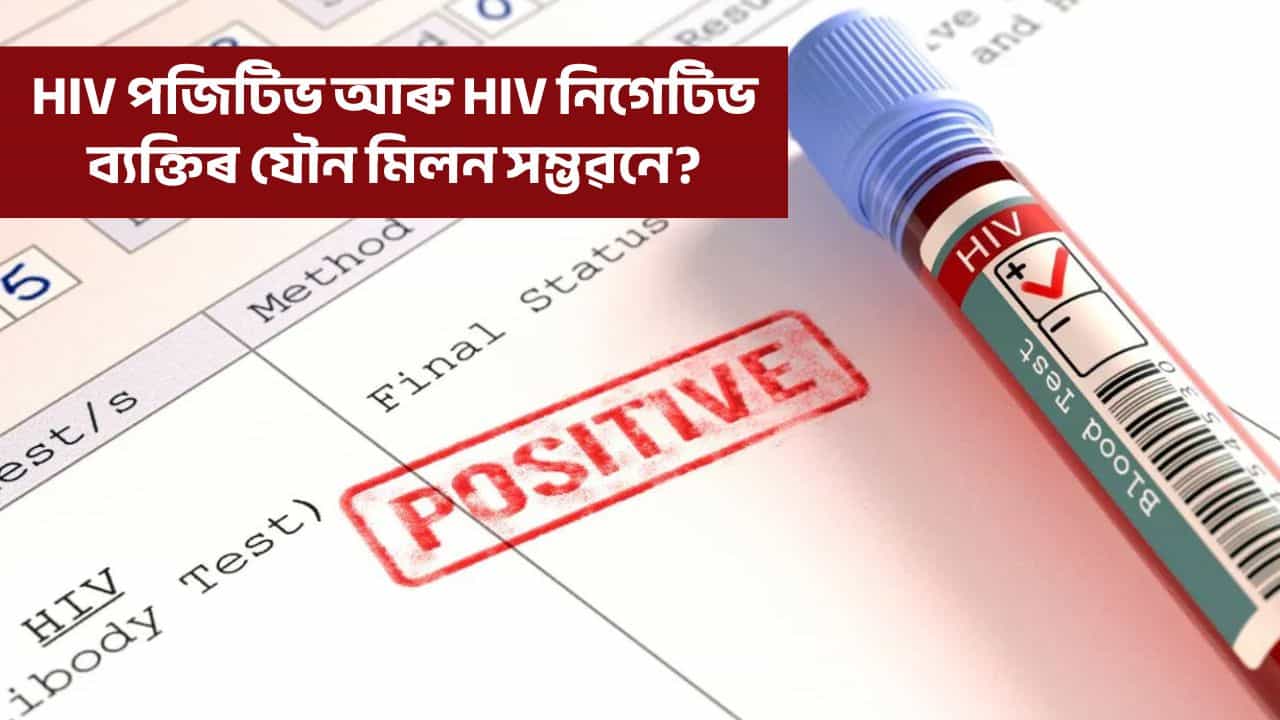 HIV পজিটিভ ব্যক্তিয়ে HIV নিগেটিভ ব্যক্তিৰ সৈতে বিবাহ হব পাৰেনে? জানক বিশেষজ্ঞসকলে কি কয়