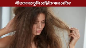 শীতকালত শুকান চুলিৰ সমস্যা তৎক্ষণাত কৰক দূৰ, অনুসৰণ কৰক এইকেইটা টিপছ...