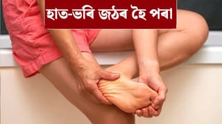 শীতকালত হাত-ভৰি জঠৰ হৈ পৰাটো ৰোগৰ লক্ষণ নেকি? চিকিৎসকৰ পৰা জানক…