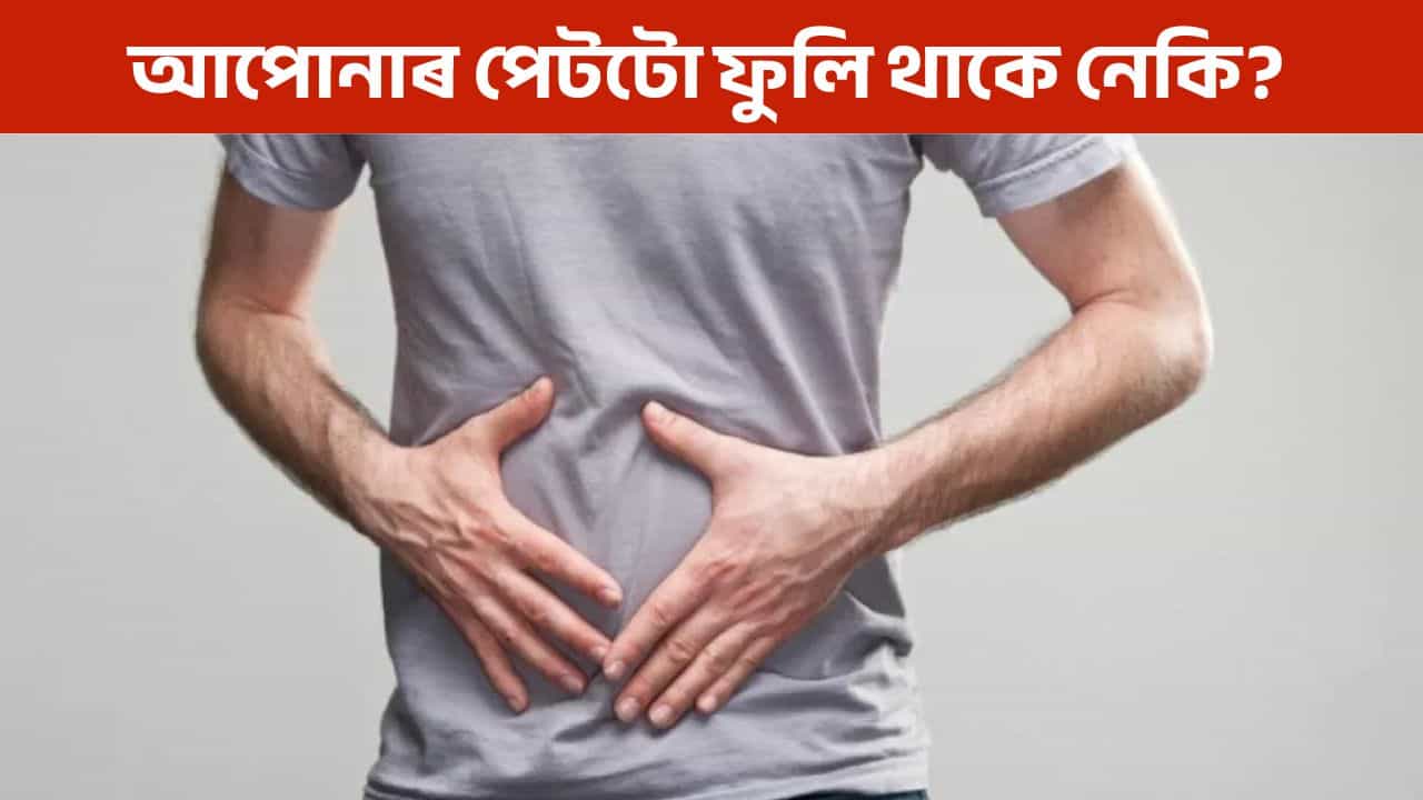শীতকালত পেটটো ফুলি থকা যেন লাগে নেকি? ঘৰুৱা পদ্ধতিৰে দূৰ কৰক পাচনৰ লগতে বিভিন্ন সমস্যা!