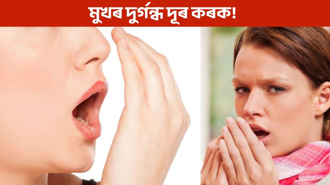 আপোনাৰ মুখৰ দুৰ্গন্ধ ওলাই নেকি? ভয়ানক ৰোগৰ ইংগিত!