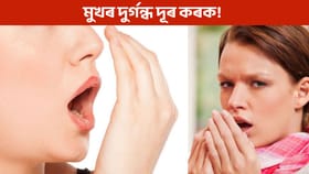 আপোনাৰ মুখৰ দুৰ্গন্ধ ওলাই নেকি? ভয়ানক ৰোগৰ ইংগিত!...