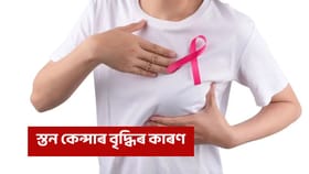 কিয় বৃদ্ধি পাইছে স্তন কেন্সাৰ? জানক ইয়াৰ লক্ষণ কি কি