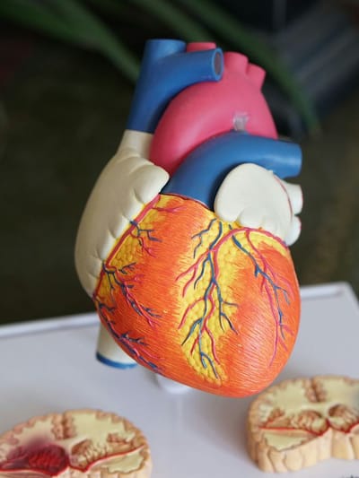 আপোনাৰ মনতো আছে নেকি হৃদৰোগৰ ভয়? এনে খাদ্যই দূৰ কৰিব হৃদযন্ত্ৰৰ চিন্তা