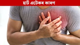 শীতকালত কিয় বাঢ়ে হাৰ্ট এটেক অহাৰ আশংকা? এনেদৰে লওক হৃদযন্ত্ৰৰ যত