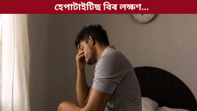 হেপাটাইটিছ বিৰ লক্ষণসমূহ কি কি? জানক চিকিৎসকৰ পৰা...