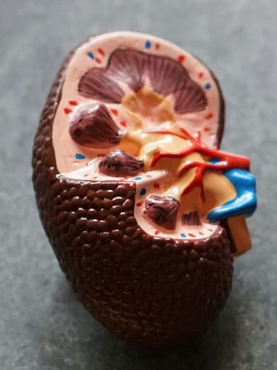 এনে খাদ্য গ্ৰহণৰ পূৰ্বে ভাবি লওক হাজাৰবাৰ, অতিমাত্ৰা খালে হ’ব পাৰে বৃক্কৰ ক্ষতি