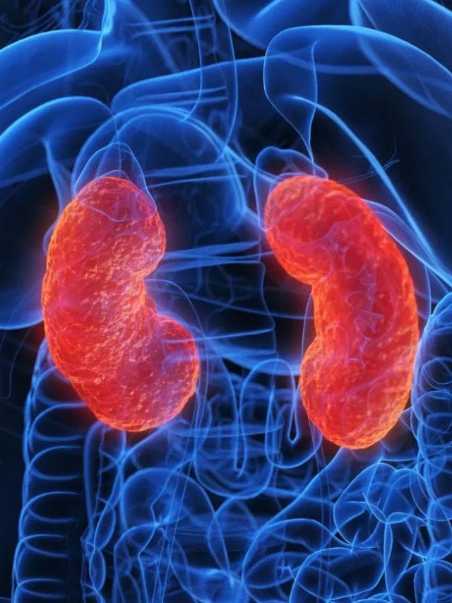 এইবোৰ খাদ্যই বৃক্কত পাথৰ হোৱাৰ সম্ভাৱনা বৃদ্ধি কৰে! সাৱধান হওক…