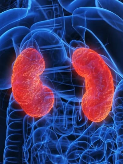 এইবোৰ খাদ্যই বৃক্কত পাথৰ হোৱাৰ সম্ভাৱনা বৃদ্ধি কৰে! সাৱধান হওক…