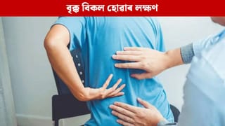 পুৱা দেখা এই ৫টা লক্ষণে দিয়ে বৃক্কৰ ক্ষতি হোৱাৰ ইংগিত, সবিশেষ জানক…