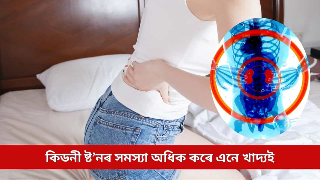 কিডনী ষ্ট’ন হৈ আছে যদি কেতিয়াও নাখাব এইসমূহ খাদ্য, অন্যথা সমস্যা হৈ পৰিব অধিক
