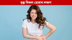 বৃক্ক বিকল হ'লে পুৱা শৰীৰত এইবোৰ লক্ষণ দেখা দিয়ে, জানক...