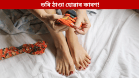 মোজা পিন্ধাৰ পাছতো ভৰি ঠাণ্ডা হৈ থাকে নেকি? হব পাৰে এই ৰোগ...