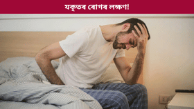 লিভাৰ নষ্ট হোৱাৰ প্ৰাৰম্ভিক লক্ষণ ৬টা জানক চিকিৎসকৰ পৰা...