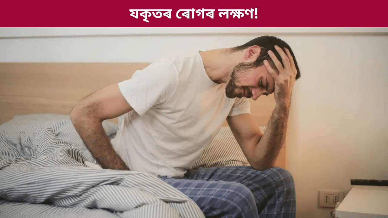 Liver: লিভাৰৰ সমস্যা হৈছে নেকি? ৬টা প্ৰাৰম্ভিক লক্ষণ কি, জানক চিকিৎসকৰ পৰা... Liver: লিভাৰৰ সমস্যা হৈছে নেকি? ৬টা প্ৰাৰম্ভিক লক্ষণ কি, জানক চিকিৎসকৰ পৰা...