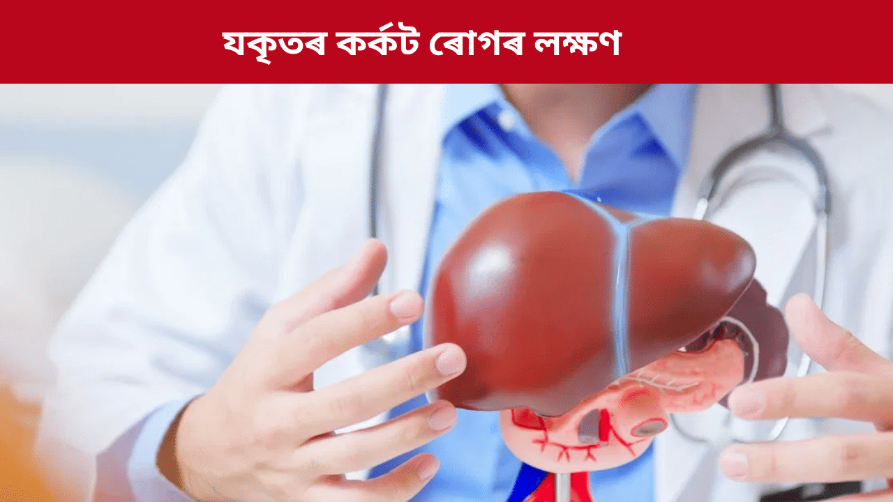 Liver Cancer Symptoms: যকৃতৰ কৰ্কট ৰোগ কিয় হয়? ইয়াৰ লক্ষণ কি, জানক চিকিৎসকৰ পৰা...