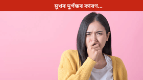 Mouth Smell: মুখৰ পৰা বেয়া গোন্ধ ওলাই নেকি? হ’ব পাৰে এই ডাঙৰ ৰোগৰ লক্ষণ, জানক সকলো…...