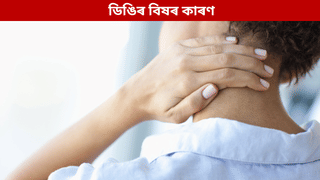 Neck Pain: ডিঙিৰ বিষ হৈ থাকে নেকি? হ’ব পাৰে এই সমস্যাৰ লক্ষণ…