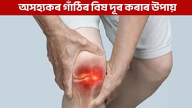 শীতত অসহ্যকৰ গাঁঠিৰ বিষত ভুগিছে নেকি? জানক কেনেকৈ সকাহ পাব