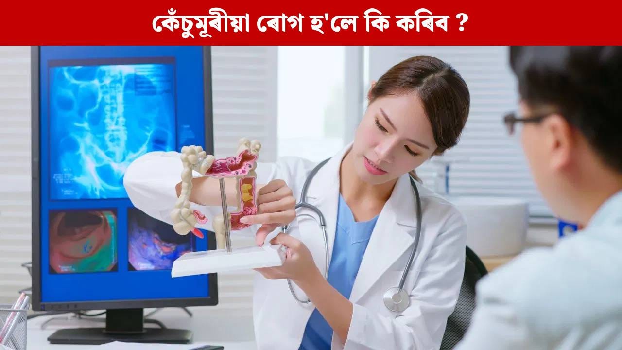 কেঁচুমূৰীয়া ৰোগ কেতিয়া জটিল হৈ পৰে ? সহজে উপশম পোৱাৰ উপায় জানক…