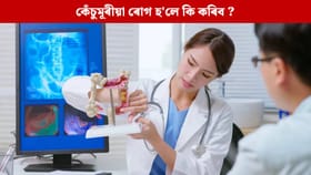 কেঁচুমূৰীয়া ৰোগ কেতিয়া জটিল হৈ পৰে ? সহজে উপশম পোৱাৰ উপায় জানক…...