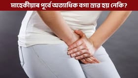 মাহেকীয়াৰ পূৰ্বে অত্যাধিক বগা স্ৰাৱ, ই কোনো ৰোগৰ লক্ষণ নেকি?...