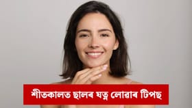 ছাল শুকান আৰু কোঁচ খাবলৈ আৰম্ভ কৰিছে নেকি ? শীতকালত ছালৰ যত্নৰ বাবে কি তেল ব্যৱহাৰ কৰিব ?...