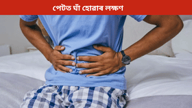 পেটৰ ভিতৰত ঘাঁ হ'লে প্ৰাৰম্ভিক অৱস্থাত কি লক্ষণে দেখা দিয়ে? জানক